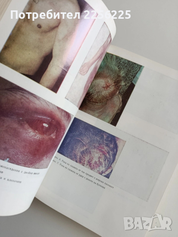 Съдебна медицина, снимка 2 - Специализирана литература - 53681354