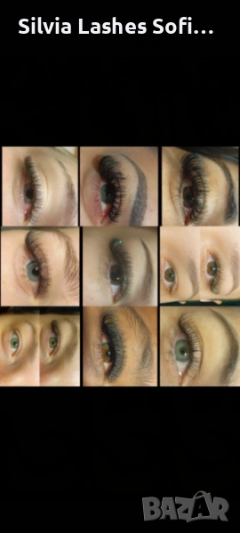 Миглопластика и масажи по домовете София , снимка 1