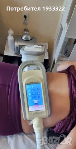  криолиполиза!, снимка 2 - Масажи - 50218280