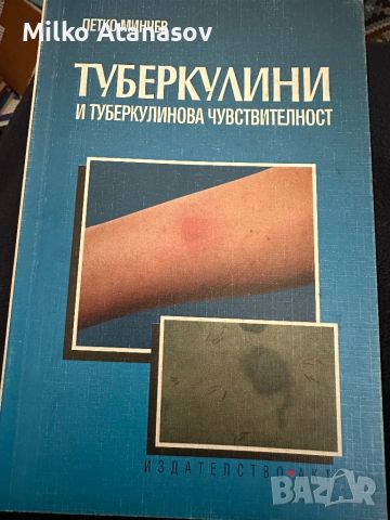 Туберкулини и туберкулинова чувствителност-П.Минчев, снимка 1