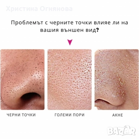 10 броя ленти за премахване на черни точки Nose Mask, снимка 5 - Други - 52677353