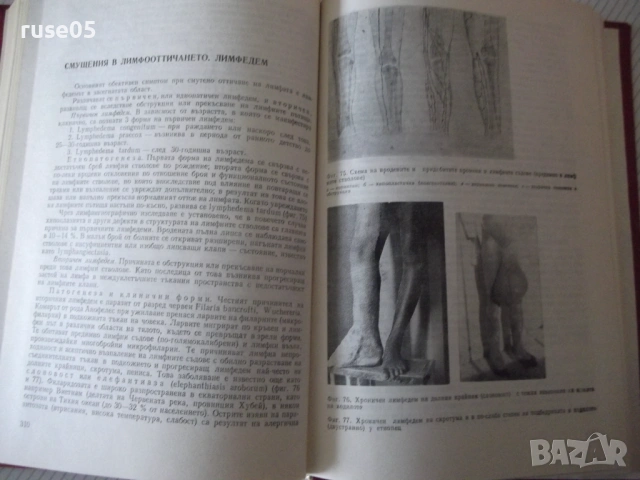 Книга "Пропедевтика на хирургичните болести-К.Енев"-376 стр., снимка 6 - Специализирана литература - 53222293