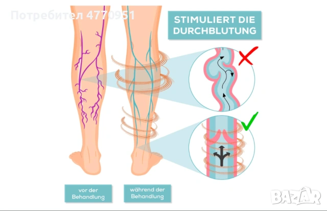 Venen Walker симулатор на кръвообръщанието, снимка 5 - Масажори - 53902625