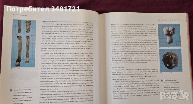 London Bodies. The Changing Shape of Londоners From Prehistoric Times to the Present Day, снимка 8 - Енциклопедии, справочници - 53748227
