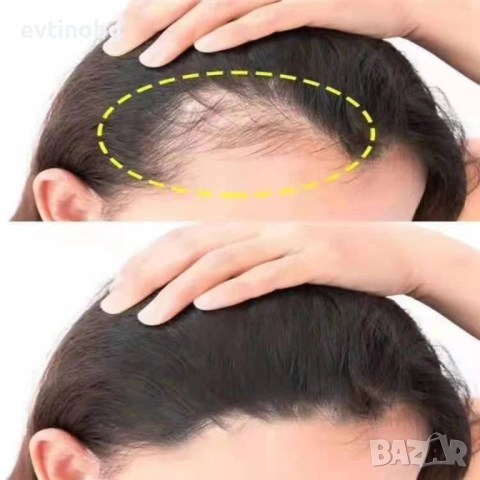 Многофункционален продукт за коса – растеж, заздравяване и сгъстяване / Количество: 30 мл; Съдържани, снимка 3 - Други - 53807835