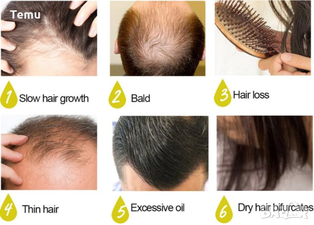 Многофункционален продукт за коса – растеж, заздравяване и сгъстяване, снимка 10 - Продукти за коса - 45792555