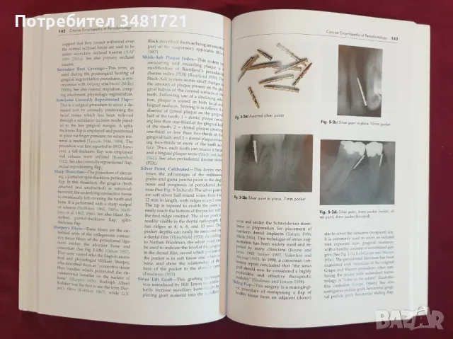 Енциклопедия на пародонтологията / Concise Encyclopedia of Periodontology, снимка 5 - Специализирана литература - 47018253