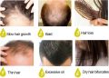 Многофункционален продукт за коса – растеж, заздравяване и сгъстяване, снимка 10