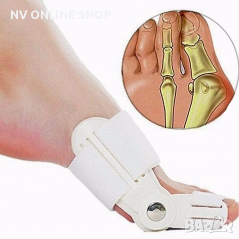 Комплект от 2 броя ортопедични фиксатори за изпъкнало кокалче, снимка 4 - Други - 53180261
