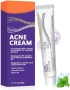 Нов Крем против акне 20g – локално третиране на пъпки и черни точки, контрол на омазняването , снимка 1