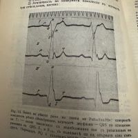 Болести на сърдцето и кръвоносните съдове д-рВитолд Орловски ,1935 г, снимка 10 - Специализирана литература - 45312150