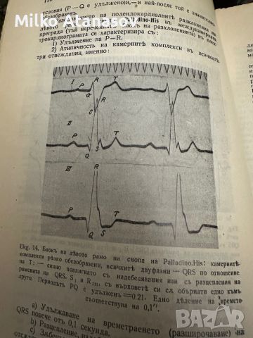 Болести на сърдцето и кръвоносните съдове д-рВитолд Орловски ,1935 г, снимка 10 - Специализирана литература - 45312150
