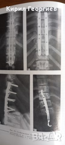 Хирургия спинного мозга, снимка 6 - Учебници, учебни тетрадки - 30548173