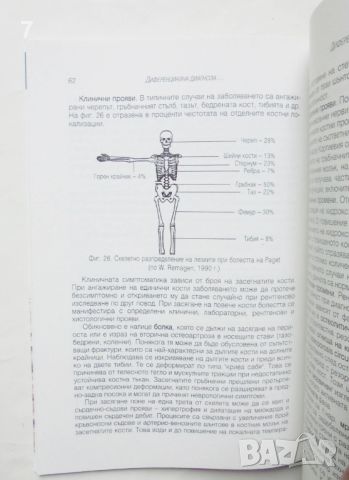 Книга Остеопороза - Йордан Шейтанов 2000 г., снимка 4 - Специализирана литература - 46142112