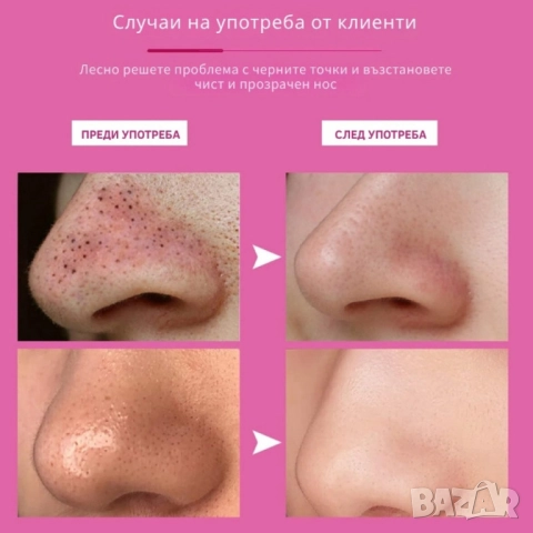 10 броя ленти за премахване на черни точки Nose Mask, снимка 4 - Други - 51968876