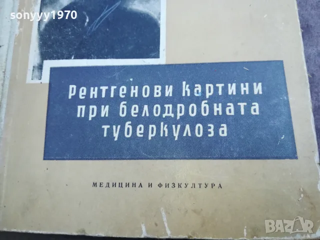 ТУБЕРКОЛОЗА 2210241119, снимка 5 - Специализирана литература - 47673891