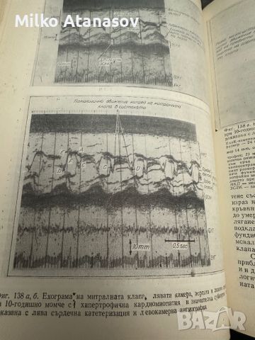 Инструментални методи за изследване на сърдечно-съдова система под ред.Л.Томов, снимка 8 - Специализирана литература - 45261395
