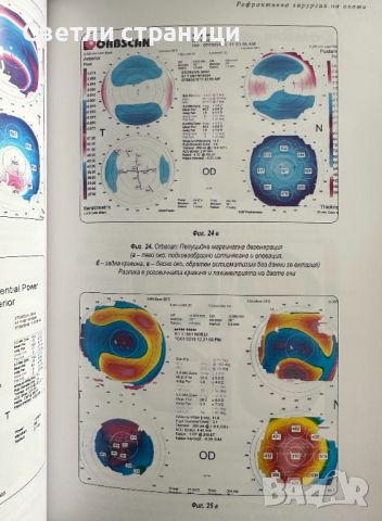 Рефрактивна хирургия на окото, снимка 4 - Специализирана литература - 45100230