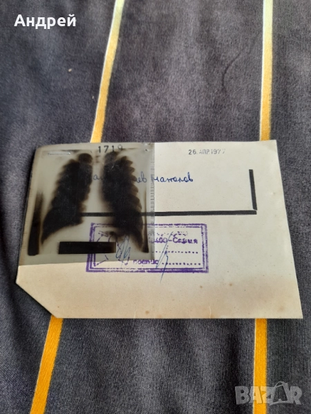 Стара ренгенова снимка 1977, снимка 1