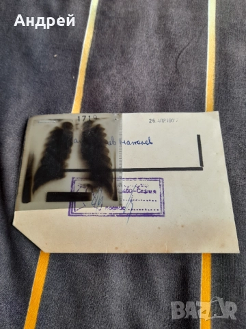 Стара ренгенова снимка 1977