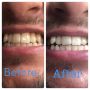 Паста за избелване на зъбите Extra white pro, снимка 6