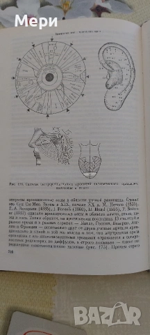 Иридодиагностика, снимка 6 - Други - 53768504