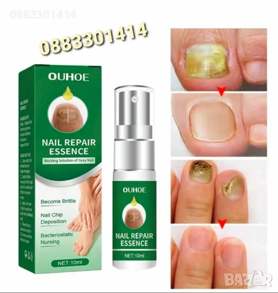 Спрей за нокти Премахва гъбички на ноктите , снимка 1