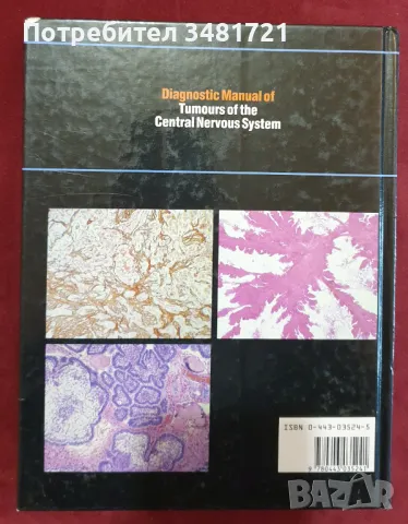 Диагностичен справочник на тумори на централната нервна система / Diagnostic Manual of Tumours, снимка 10 - Специализирана литература - 48272919