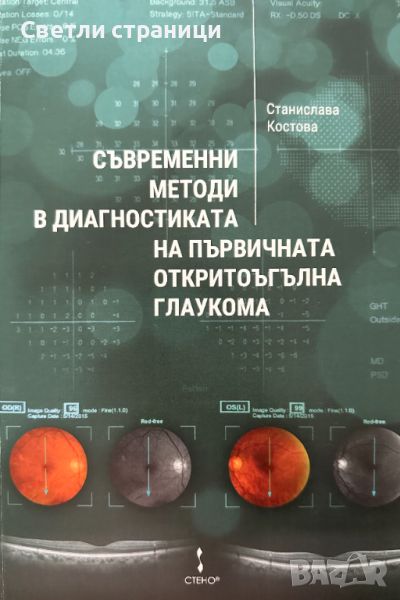 съвременни методи в диагностиката на първичната откритоъгълна глаукома, снимка 1