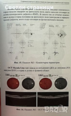 съвременни методи в диагностиката на първичната откритоъгълна глаукома, снимка 4 - Специализирана литература - 46550822