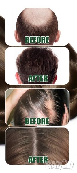 Многофункционален продукт за коса – растеж, заздравяване и сгъстяване, снимка 1