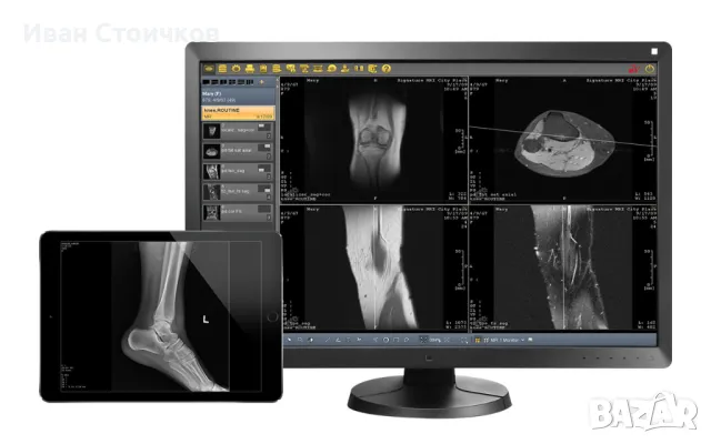 PACS DICOM / Пакс - дайком, снимка 2 - Други услуги - 47200610