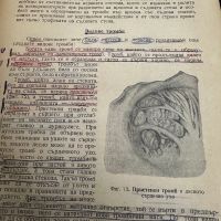 Обща патология -Боян Кърджиев ,1955, снимка 9 - Специализирана литература - 45384490