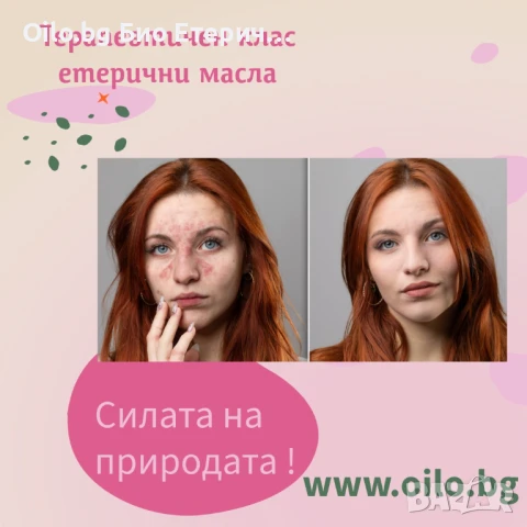 Етеричните масла – натуралната грижа за здрава кожа, релакс и баланс! Мария от Пловдив победи екзема