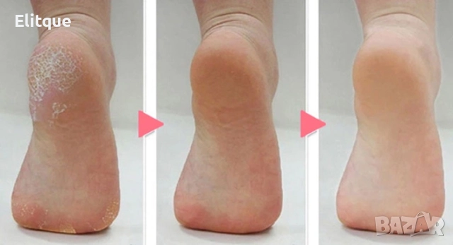 Електрически уред за пилинг на пети и кожички, снимка 8 - Електрически пили за пети - 52901533