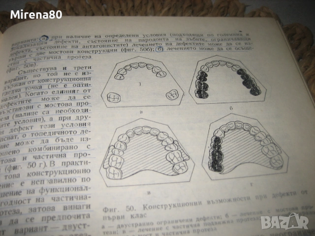 Клиника на ортопедичната стоматология - 1984 г., снимка 7 - Специализирана литература - 53529249
