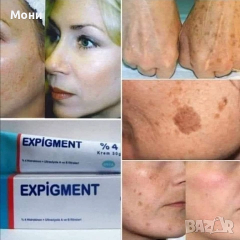  Expigment крем за петна по лицето