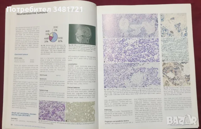 Тумори на главата и врата / Pathology & Genetics. Head and Neck Tumours, снимка 7 - Специализирана литература - 47891566