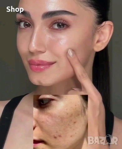 -50% Tretinoin cream , снимка 3 - Козметика за лице - 53343117