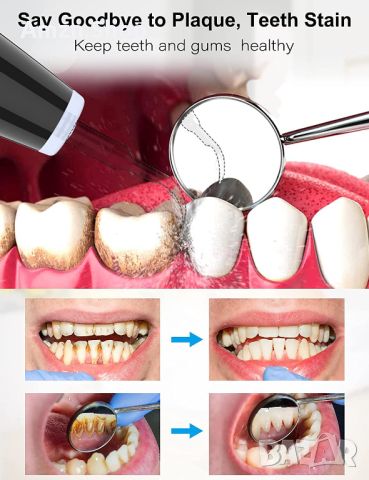 Комплект за почистване на зъби премахване на зъбен камък Ултразвуков комплект, снимка 4 - Други - 46146383