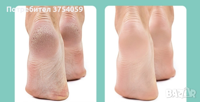 Електрически уред за премахване на мъртва кожа от петите, снимка 8 - Електрически пили за пети - 52364914