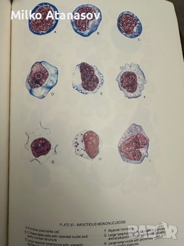 Хематологичен Атлас-The Morphology of Human Blood Cells-Abbot laboratories,1985,p.92, снимка 11 - Специализирана литература - 45372137