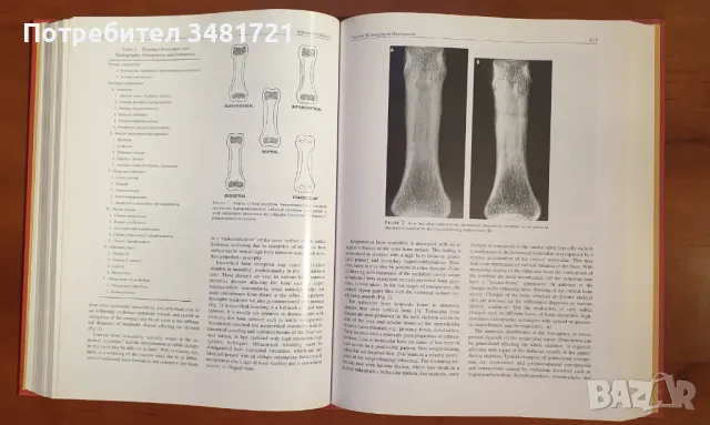 Професионален справочник - остеопороза / Osteoporosis, volume 2, снимка 8 - Специализирана литература - 46826159