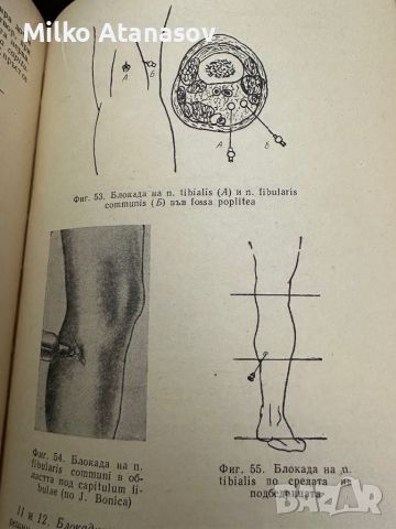 Новокаинът в съвременната терапия -В.Янчев,1963,стр.211, снимка 12 - Специализирана литература - 45304720