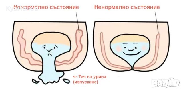 Уред за стягане на тазовото дъно. Патентована технология, снимка 6 - Фитнес уреди - 45693706