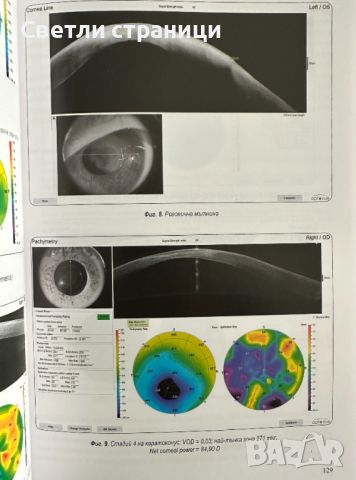 Рефрактивна хирургия на окото, снимка 5 - Специализирана литература - 45100230