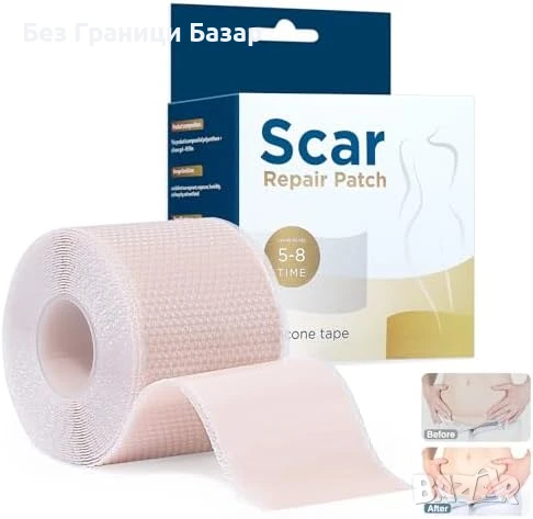 Нова Медицинска силиконова лента против белези 4см x 3м – за многократна употреба, снимка 1