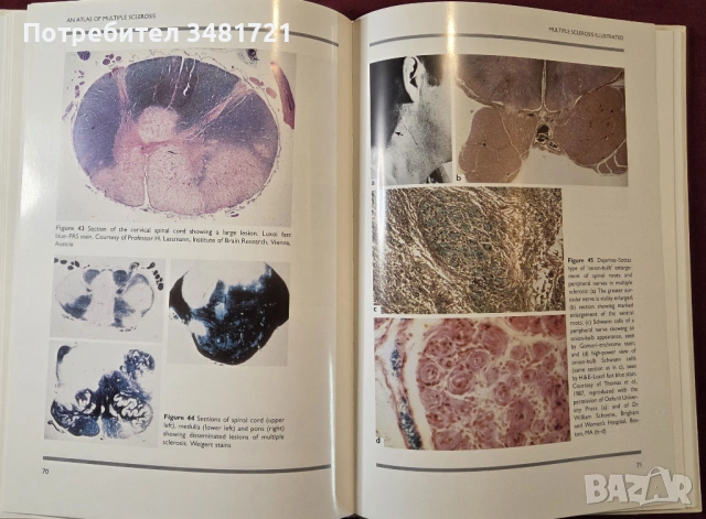 Голям атлас на множествената склероза / An Atlas of Multiple Sclerosis, снимка 10 - Специализирана литература - 53748194