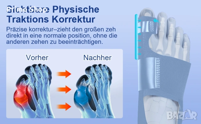 Шина за корекция на изпъкнало кокалче Hallux Valgus и разделител за пръсти, снимка 10 - Други - 53736700