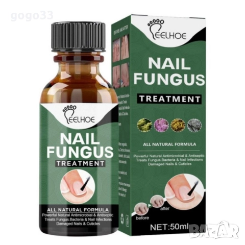 лак против гъбички , снимка 5 - Други - 51861216